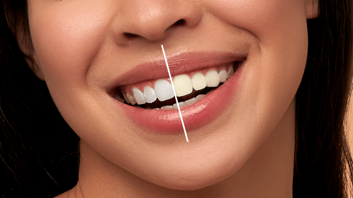 Dentistika kozmetike