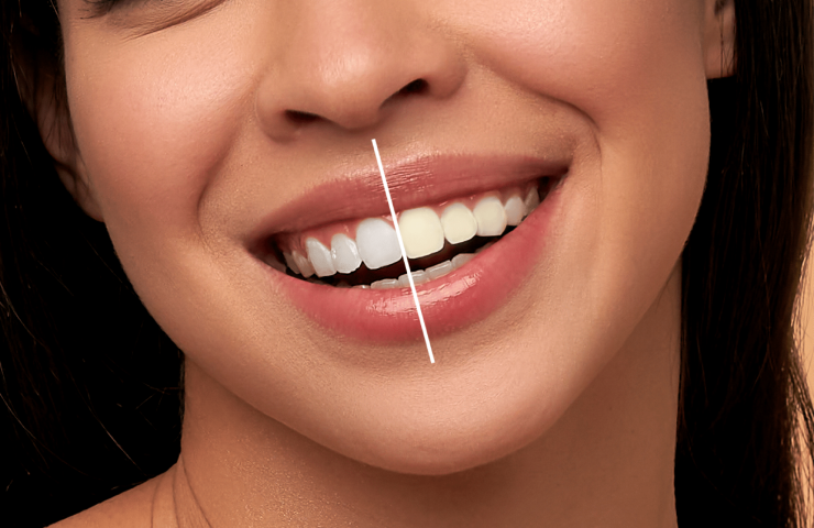 Dentistika kozmetike